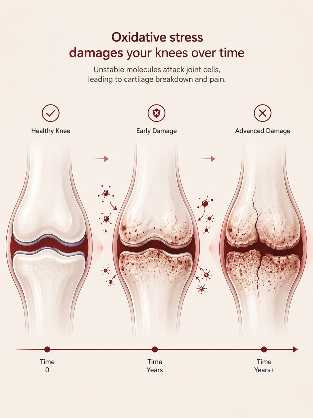 Oxidative stress damages your knees over time