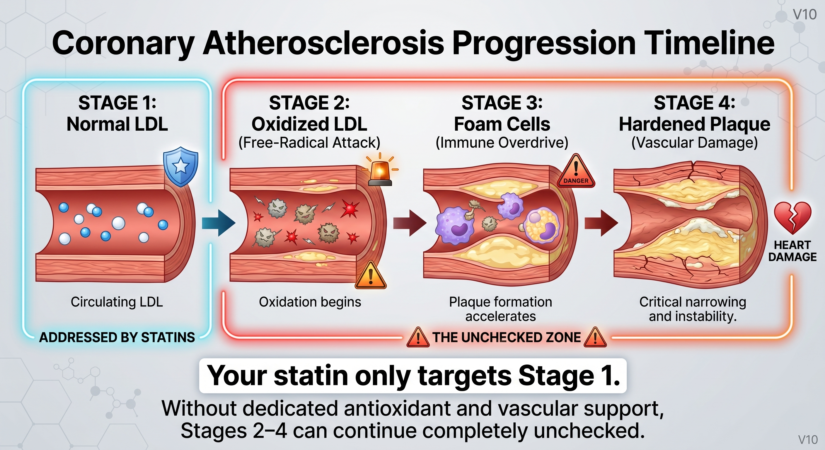 Four-stage diagram: normal LDL, oxidized LDL under free-radical attack, foam cell formation, and mature arterial plaque.