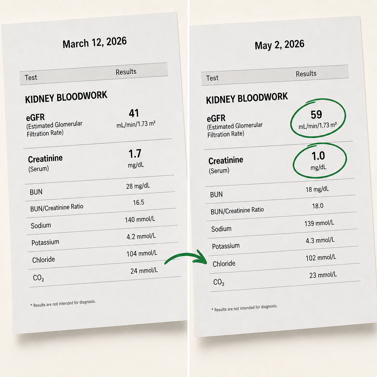 Two kidney bloodwork panels side by side, March 12, 2026: eGFR 43, creatinine 1.7; May 2, 2026: eGFR 49 and creatinine 1.0, both circled