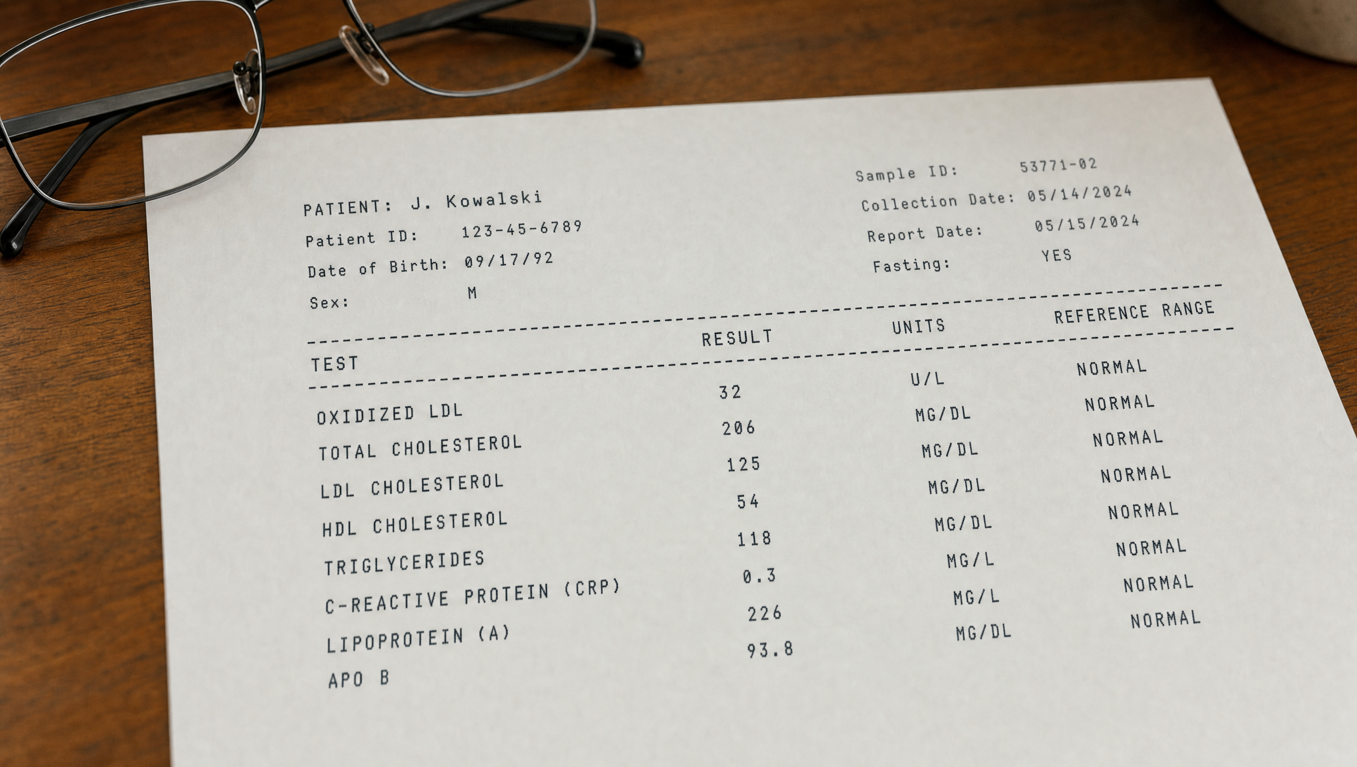A fasting lipid lab report on a wooden desk beside reading glasses. The first line reads OXIDIZED LDL with a result of 32 and a reference range of NORMAL.