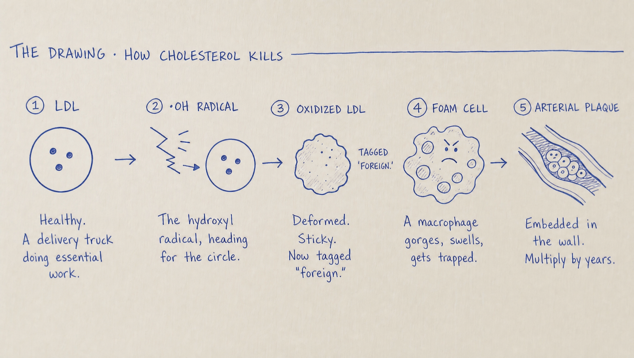 Hand-drawn diagram titled How Cholesterol Kills: 1 LDL, a healthy delivery truck; 2 hydroxyl radical striking it; 3 oxidized LDL, deformed and tagged foreign; 4 foam cell; 5 arterial plaque embedded in the wall.