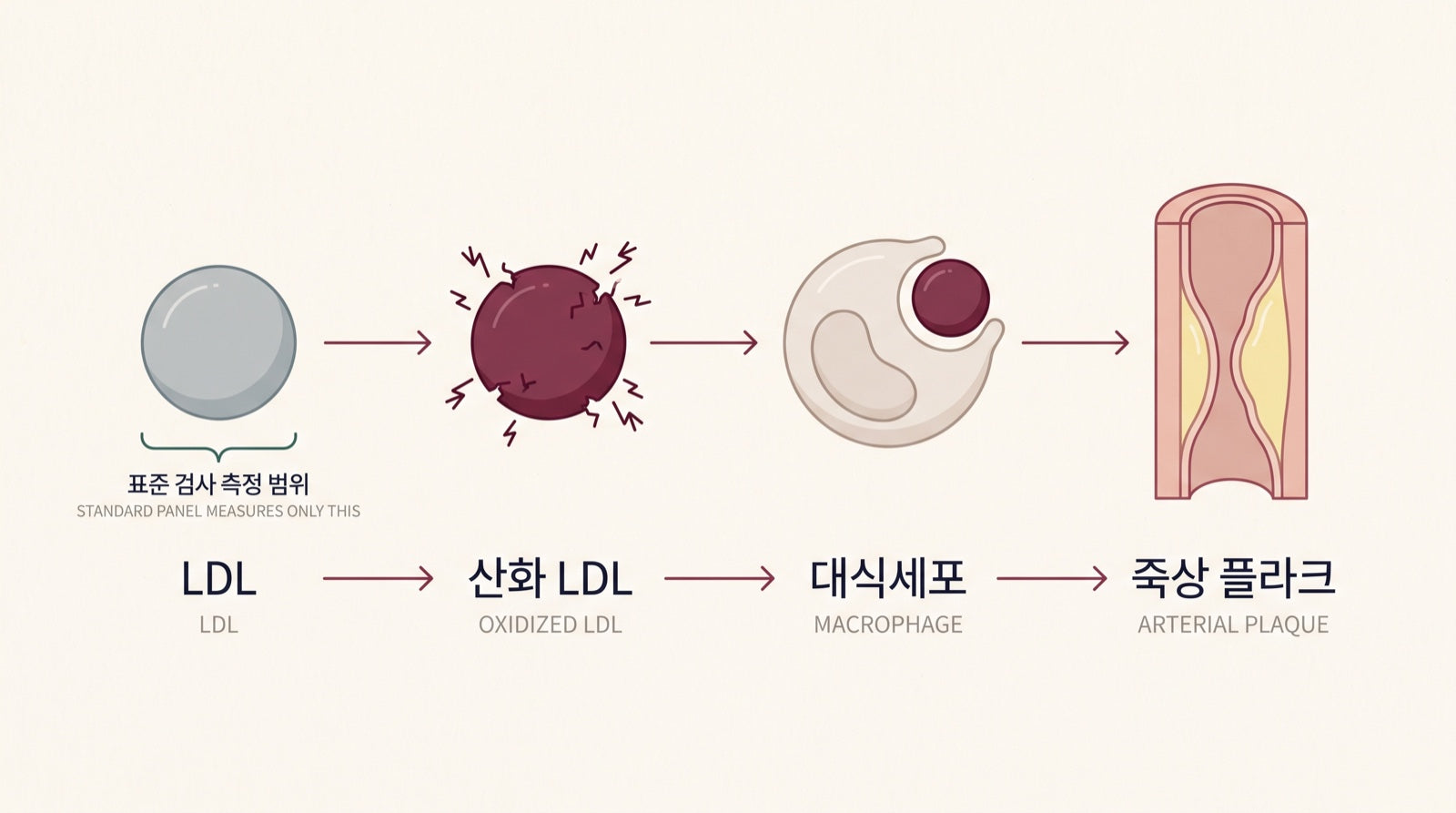Editorial diagram in Korean and English showing an LDL particle attacked by free radicals to become oxidized LDL, engulfed by a macrophage, and deposited as arterial plaque, with a bracket marking that the standard panel measures only the first stage.